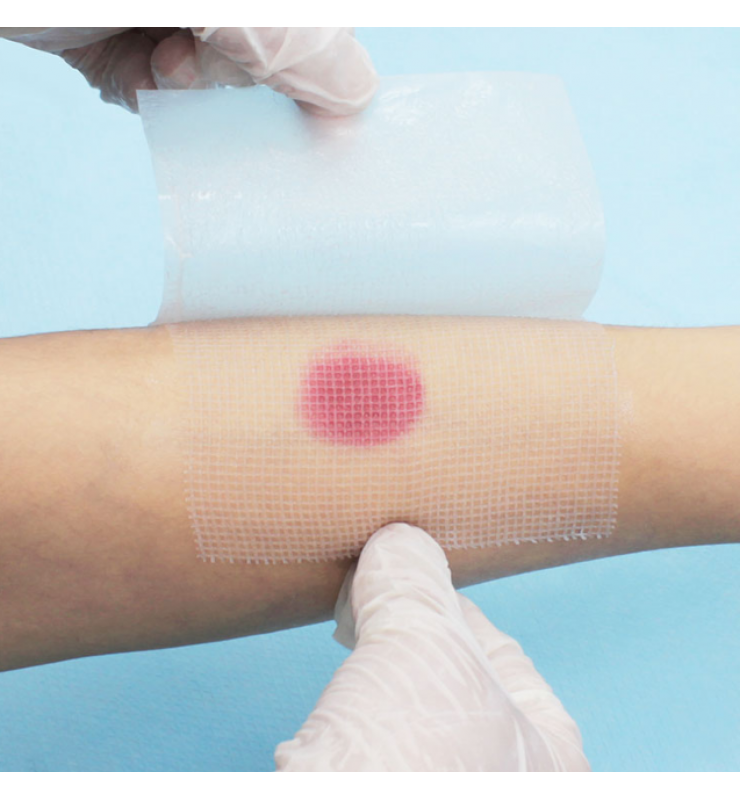 Paraffin Impregnated Gauze Pad