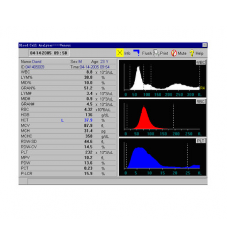 Medical Equipment Fully Auto Hematology Analyzer